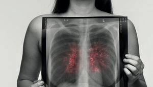 Lung Cancer, See Through The Symptoms